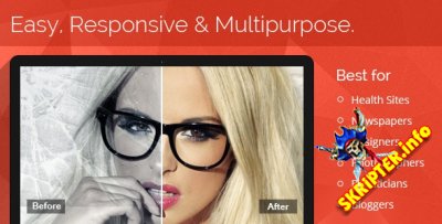 Multipurpose Before After Slider v2.7.0 -    Wordpress